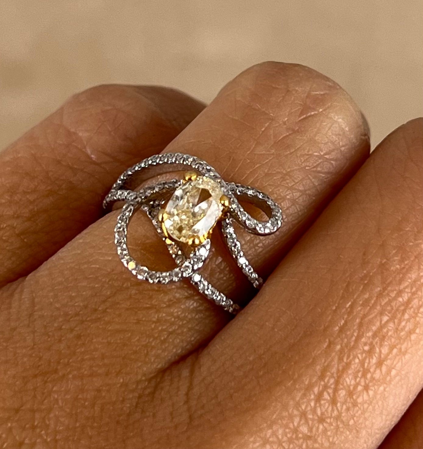 Diamantring